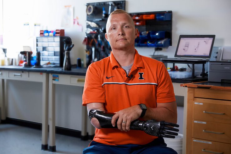 Sergeant Garrett Anderson with Psyonic prosthetic Sergeant Garrett Anderson with Psyonic prosthetic