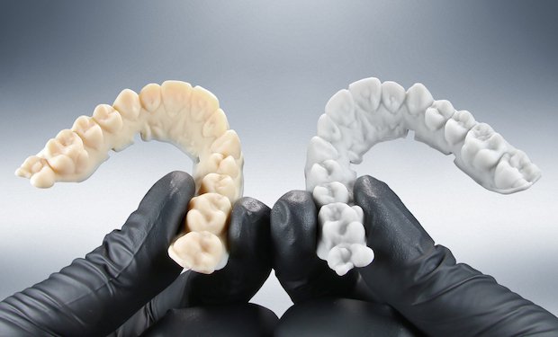 EnvisionTEC dental arches