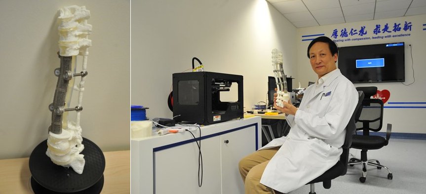 AK Medical GE Additive AK Medical GE Additive