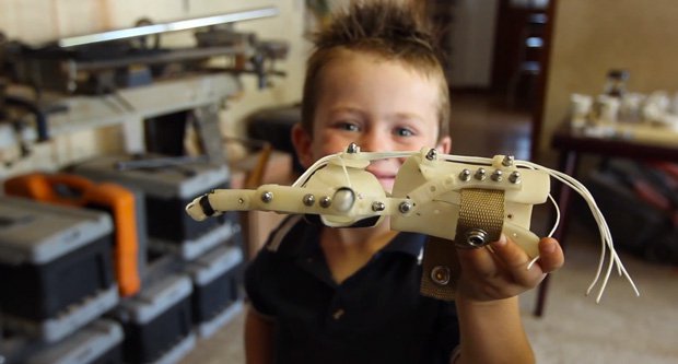 Liam with his RoboHand