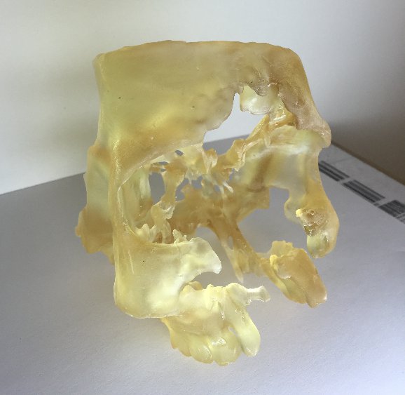 Skull-3d-print.png Skull-3d-print.png