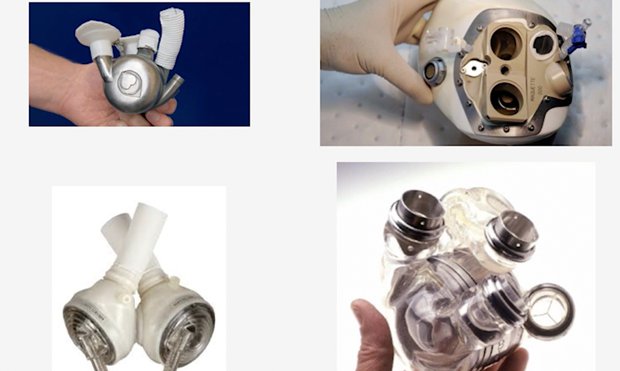 Traditional Mechanical Heart Pumps