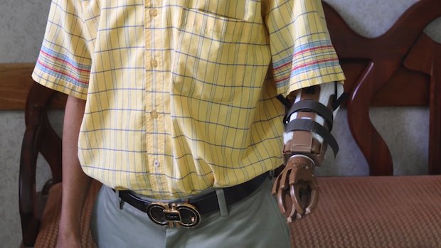 Portland Rotary prosthetics Portland Rotary prosthetics