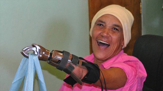 Portland Rotary prosthetics 6.png Portland Rotary prosthetics 6.png