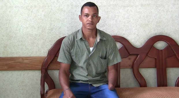 Portland Rotary prosthetics 3.png Portland Rotary prosthetics 3.png