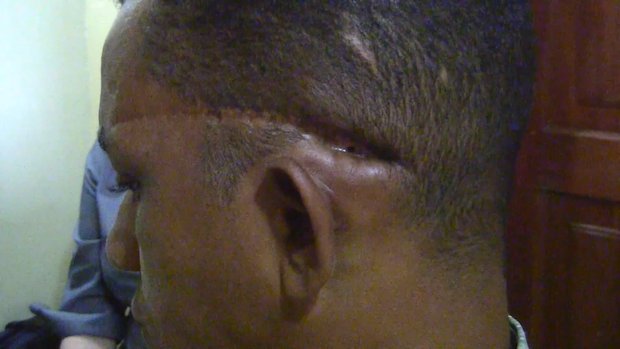 Portland Rotary prosthetics 4.png Portland Rotary prosthetics 4.png