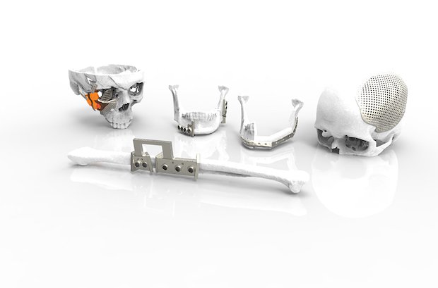 Renishaw Implant montage