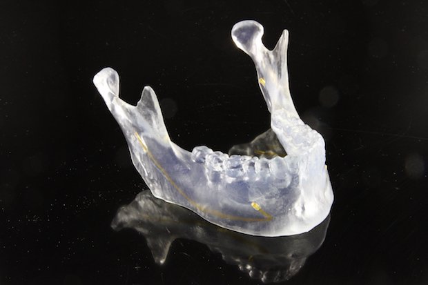 Image 6 part printed with Aurora