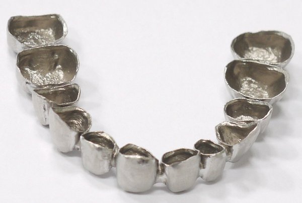 Metal crown printed by Sinterex.jpg Metal crown printed by Sinterex.jpg