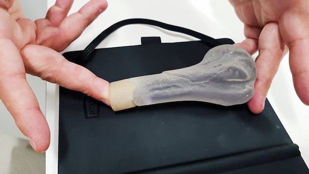 Humerus WMG Humerus WMG