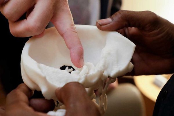 axial 3D skull TMH axial 3D skull TMH