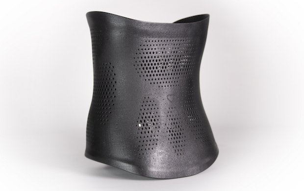 Rear photo of the 3D printed torso brace.jpg Rear photo of the 3D printed torso brace.jpg