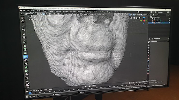 Modelling inside the Artec Studio software. Facial nerve Modelling inside the Artec Studio software. Facial nerve