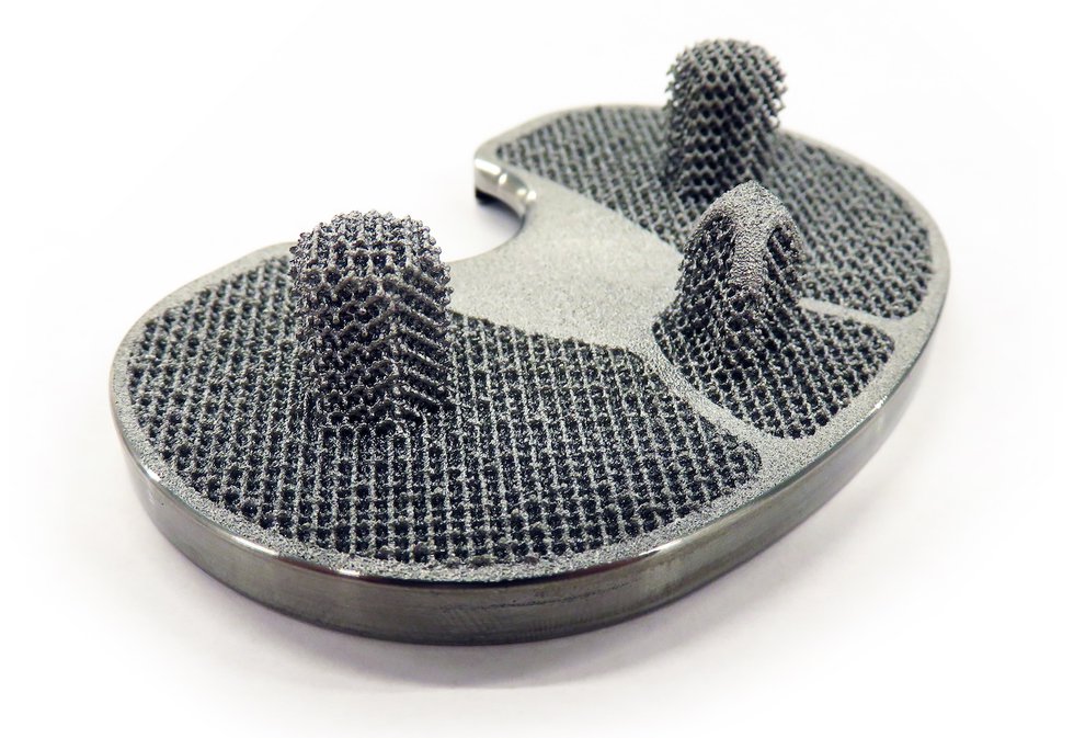 Printed tibial implant Printed tibial implant