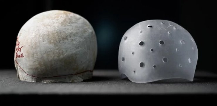 NHS Bristol 2.png NHS Bristol 2.png