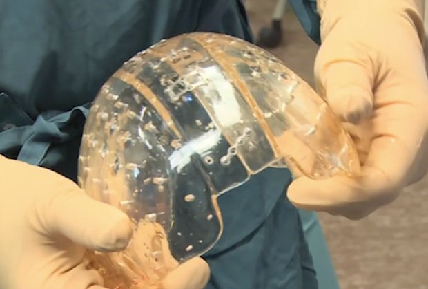 3D-printed skull 3D-printed skull