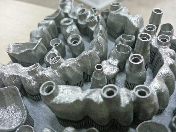 Dental implants Dental implants