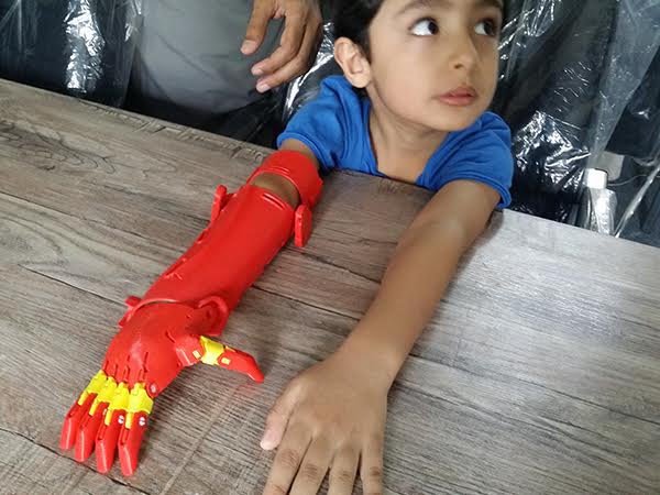 Bioniks 3D arm Bioniks 3D arm