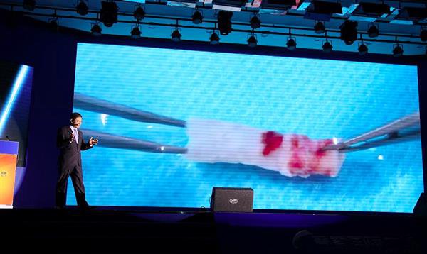 Chinese research blood vessels Chinese research blood vessels