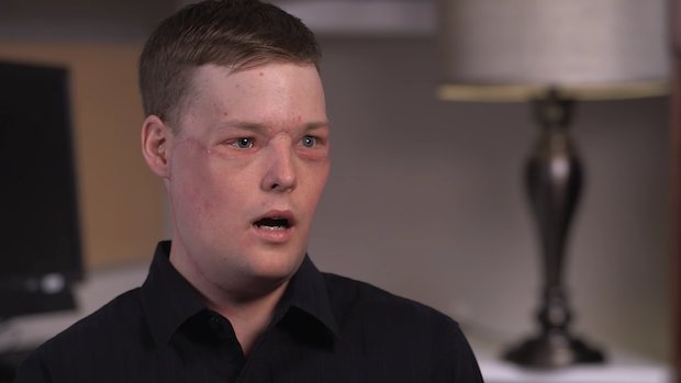 Mayo Clinic Andy Sandness Mayo Clinic Andy Sandness