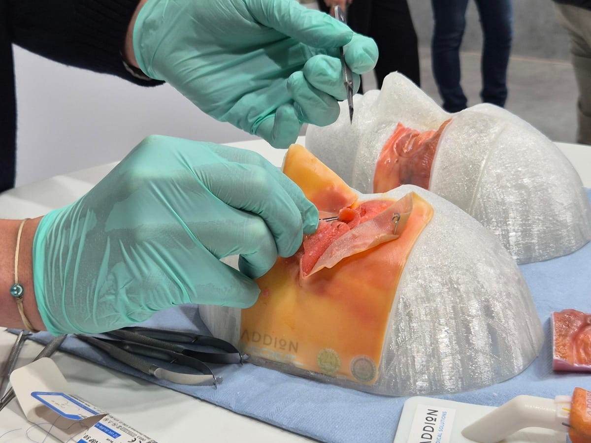 How Addion is using 3D printing to support the development of eye surgery planning models