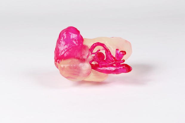 3D Systems healthcare      Previous 3D Systems work with 3D printed kidney models.