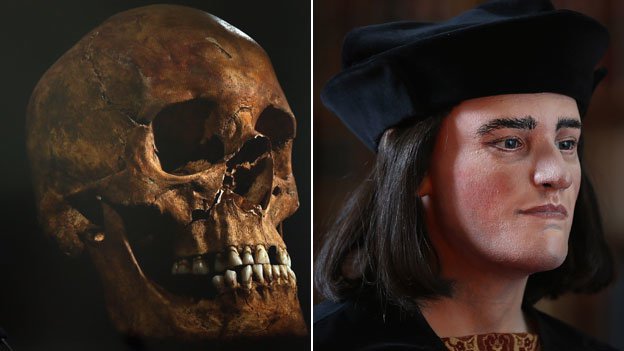 Skull and Reconstruction of Richard III - BBC