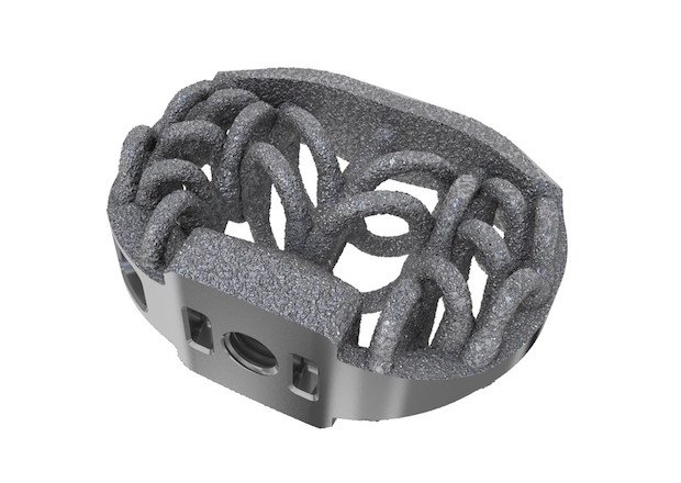 SPIRA™ Open Matrix ALIF      Camber Spine SPIRA Open Matrix ALIF - Hand-out Camber Spine Technologies