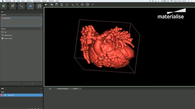 Creating a heart model inside Materialise's Mimics inPrint software. - Materialise/ YouTube