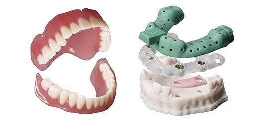 Dentures - Carbon/ Twitter