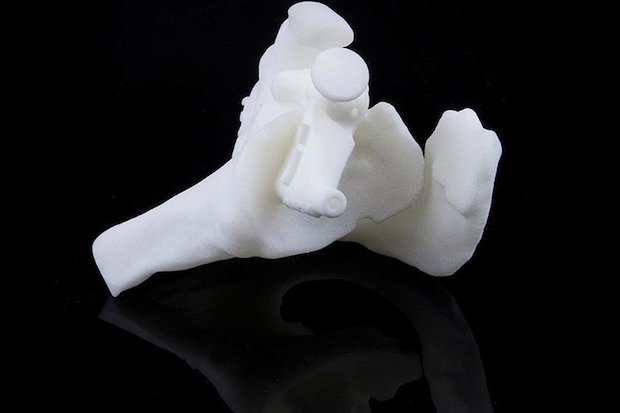 Materialise shoulder model      Patient-Specific Shoulder Guide. - Materialise