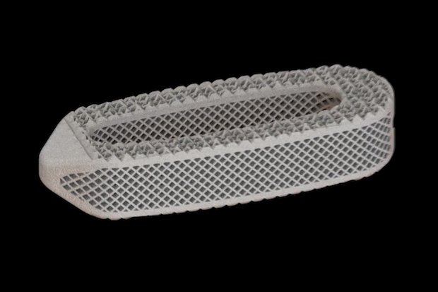 Osseus Fusion Systems spine implant      3D printed lumbar interbody fusion device manufactured by Osseus Fusion Systems. - Osseus Fusion Systems