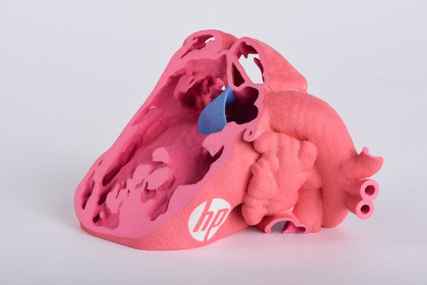 Congenital heart model HP Materialise Models      Congenital heart model printed with HP's colour Jet Fusion technology. - HP