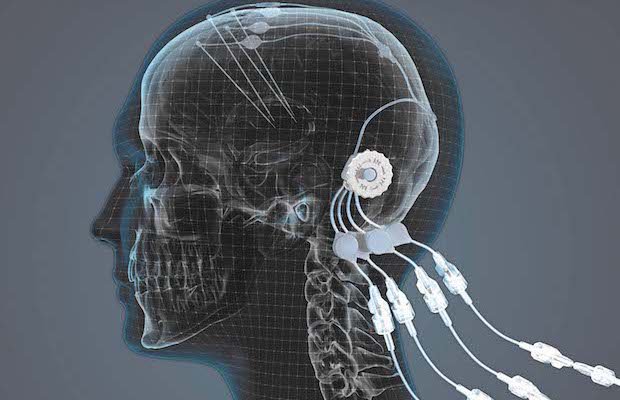 Credit: Chris Marshall/Mint Motion