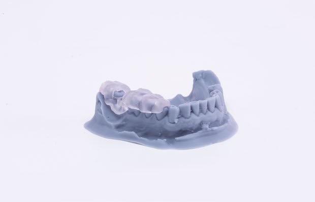 3D Printed Surgical Guide on a Dental Impression      3D Printed surgical guide on dental impression. - Zortrax