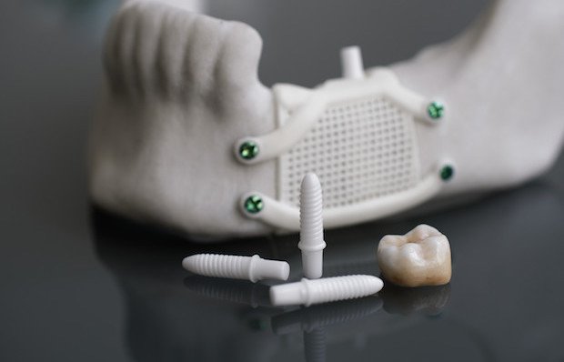 Zirconia is used to restore lost teeth or tooth substance by means of tooth supported crowns, fixed dental prostheses and defect-oriented restorations.
