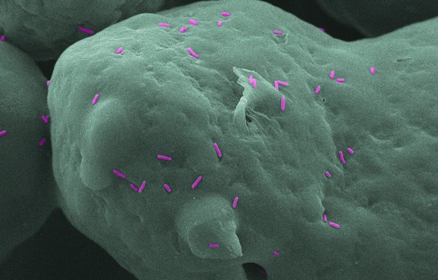 Individual bacteria on a Nylon-12 surface. - Chris