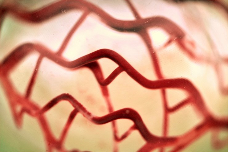 3D bioprinted soft tissue scaffold with vascularisation channels perfused with red ink designed and produced using 3D Systems' and CollPlant's expertise and solutions.