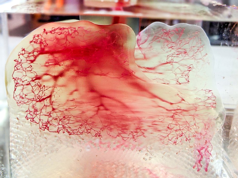 Human vasculature model created with 3D Systems' Print to Perfusion bioprinting technology. - United Therapeutics