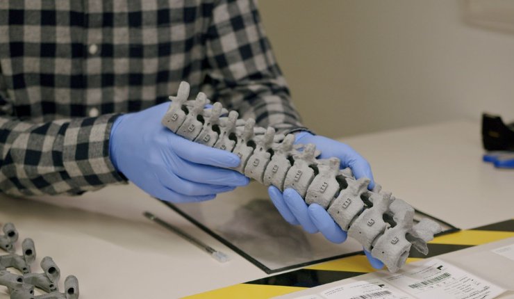 3D printed spinal model - Mighty Oak Medical