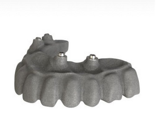 Renishaw dental bridge