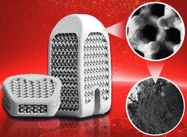 Hydroxyapatite-Coated Porous Titanium Alloy Interbody Fusion Device developed by Wedo - Bright Laser Technologies