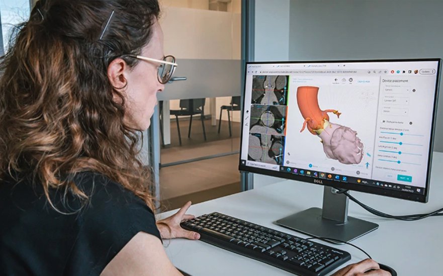 Materialise will integrate FEops' AI-driven simulation into its Mimics Planner for Structural Heart Interventions - Materialise