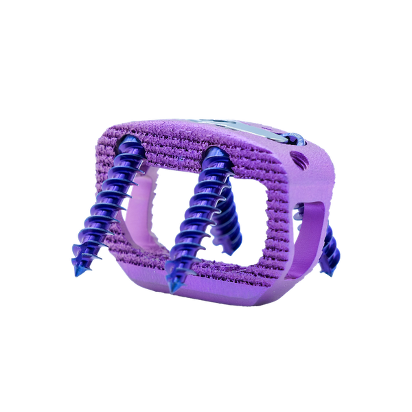 Acuity's Ventris ALIF device. - Acuity Surgical Devices