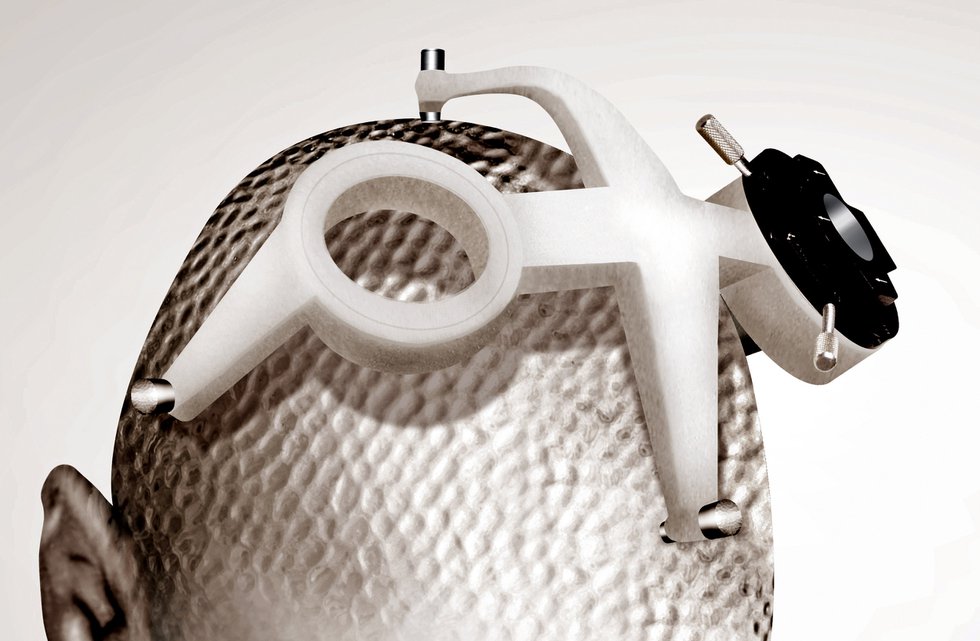 EOS Surgical Guides      FHC has transformed stereotaxy in neurosurgery using a 3D modelling process based on each patient’s anatomical coordinates. A unique operating platform is then pro...