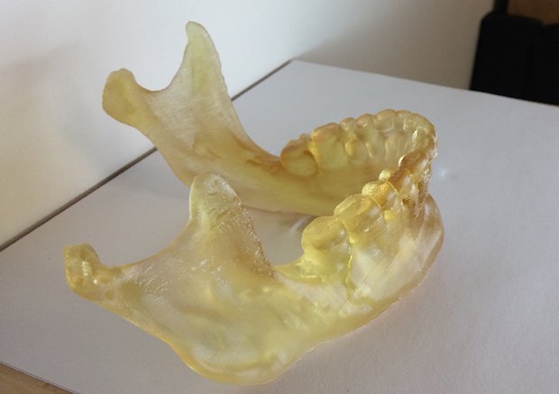 Jaw 3D printed by NewPro3D.