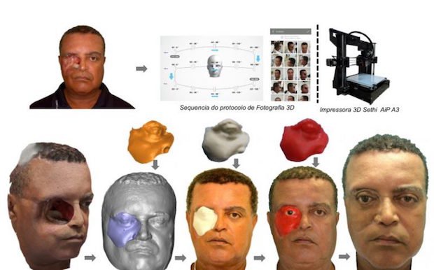 Brazilian man face prosthesis Plus ID      The full Plus ID process - Plus ID/ Caters News