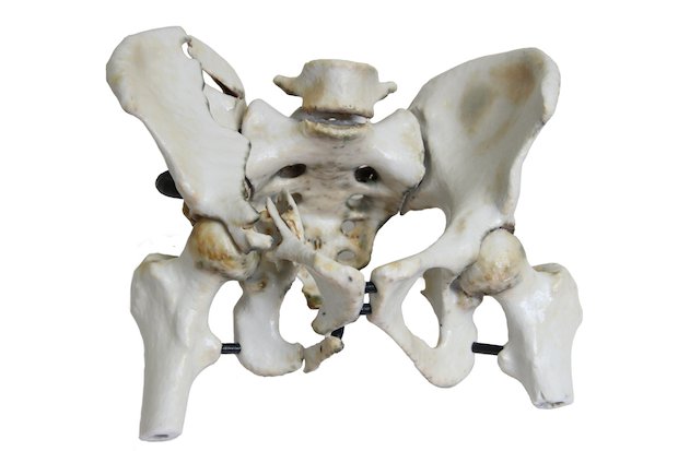 3D pelvis      3D structure of the pelvis region with multiple fractures - TeraRecon