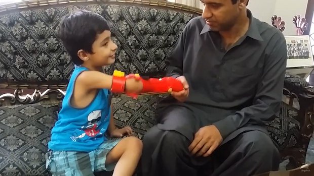 Bioniks 3D printed superhero arm      Mir's uses his Iron Man-themed arm to shake hands