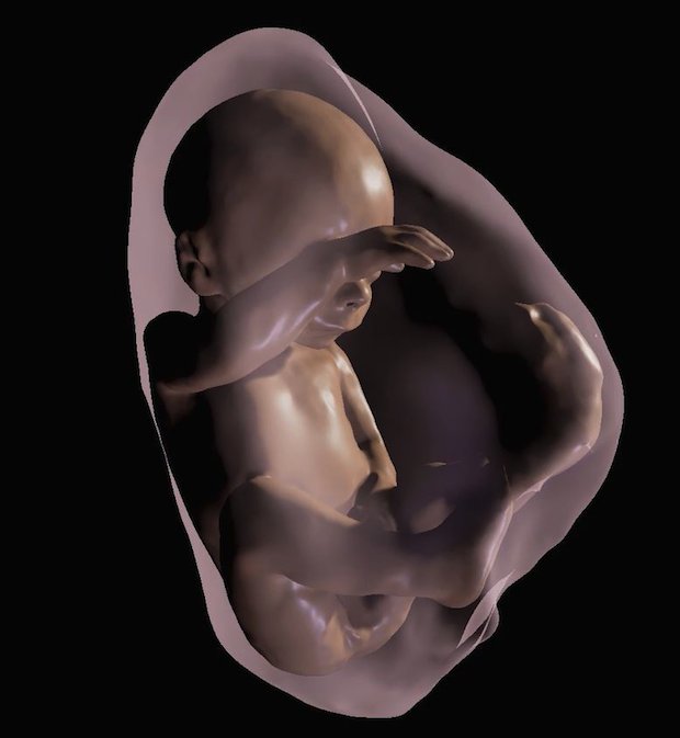 3D foetus model      3D virtual model MRI view of foetus at 26 weeks.